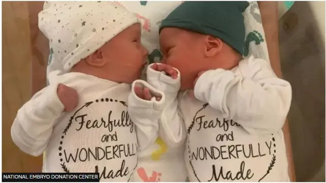 Ụmụ ejima Lydia Ann na Timothy Ronald