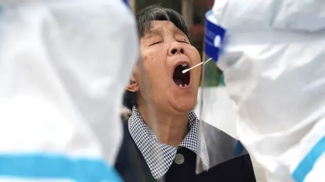 Nnyocha ime ahụ ndị mba Chaịna