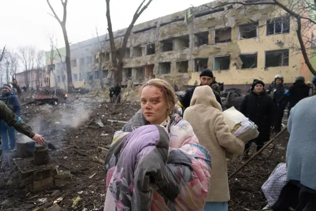 Жінка, яка рятується після обстрілу пологового будинку у Маріуполі