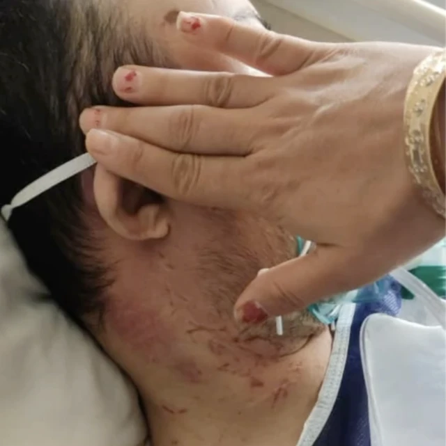 محمد، توانخواه سندرم داون
