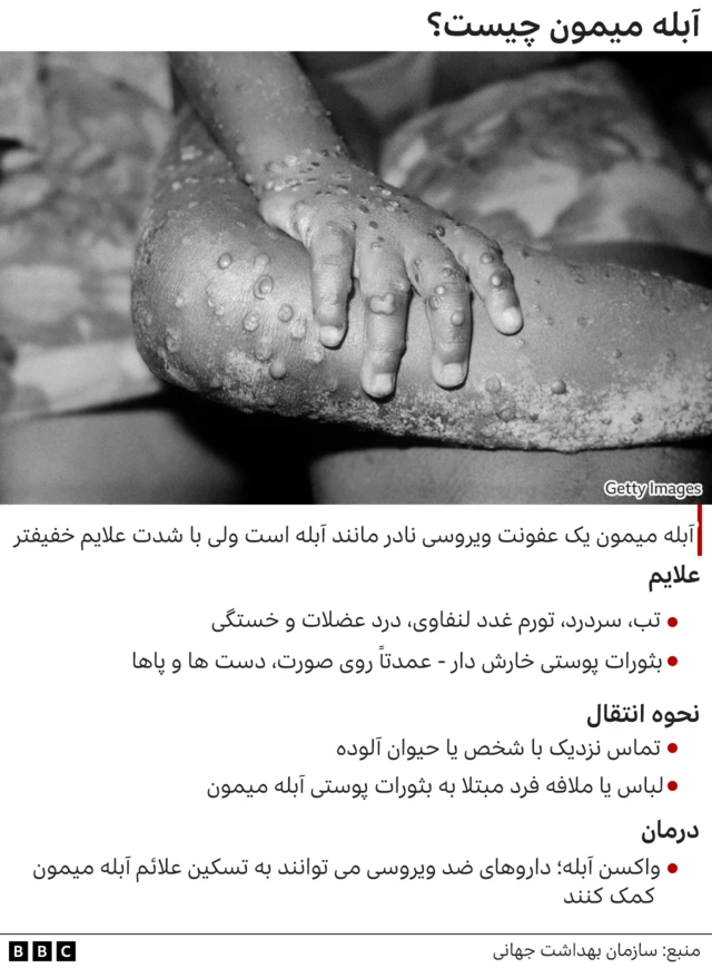 آبله میمون
