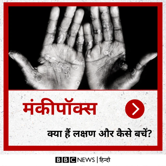 मंकीपॉक्स