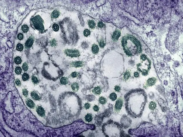 Marburg Virus