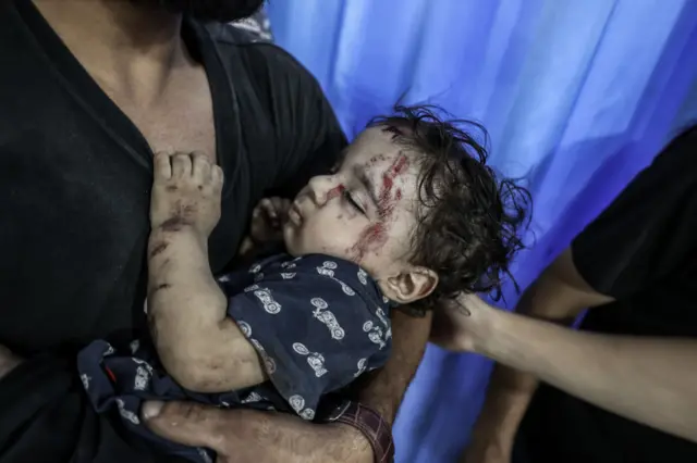 طفلة فلسطينية جريحة
