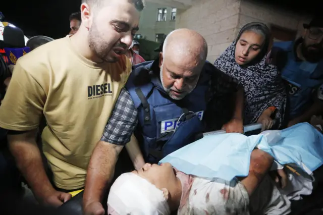 مراسل الجزيرة يتفقد ابنته الجريحة