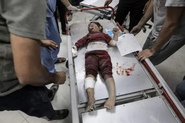 Ilmo yar oo ku dhaawacmay duqeynta Israa'iil