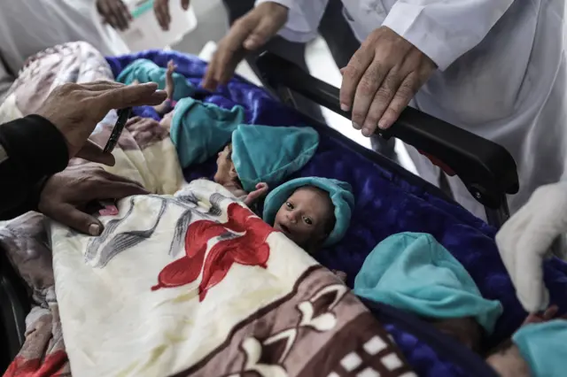 الأطفال الخدج خلال الاستعداد لنقلهم إلى مصر من أجل العلاج