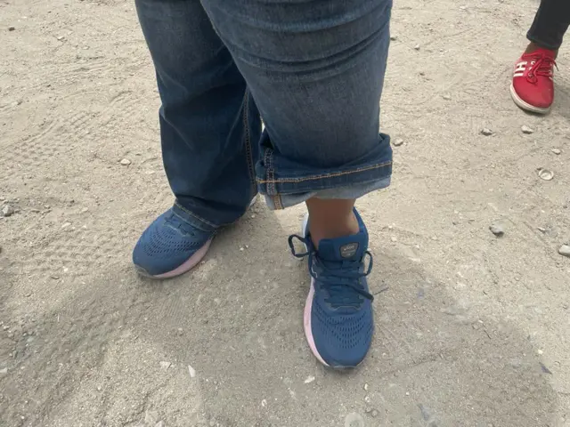Ụkwụ otu nwaanyị na-etezị ụkwụ dịka ọ chịpụrụ ụkwụ ebe ọ na-agba ọsọ ndụ ya na Lekki