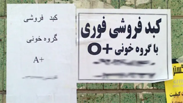 آگهی فروش کبد
