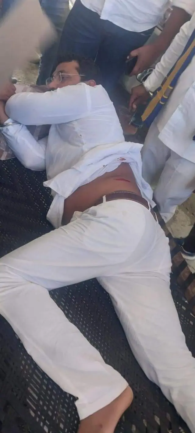 चंद्रशेखर आज़ाद को गोली छूकर निकली