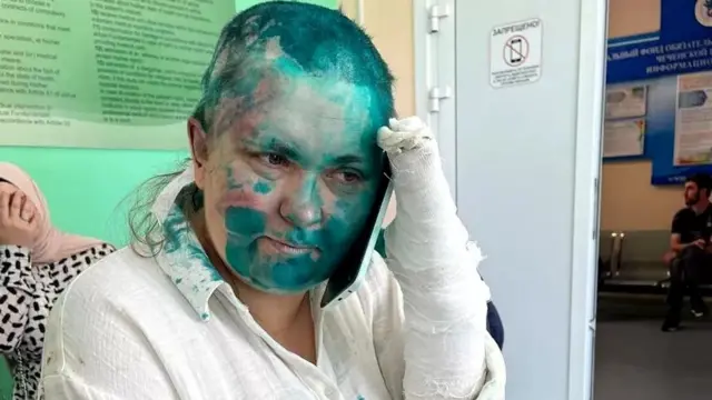 Yelena Milashina na wakili Alexander Nomov walipelekwa hospitali kwa kutibiwa ya majeraha waliyopata