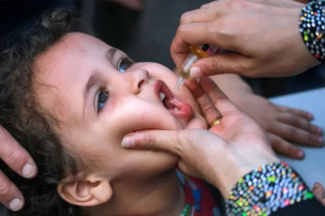 Polio
