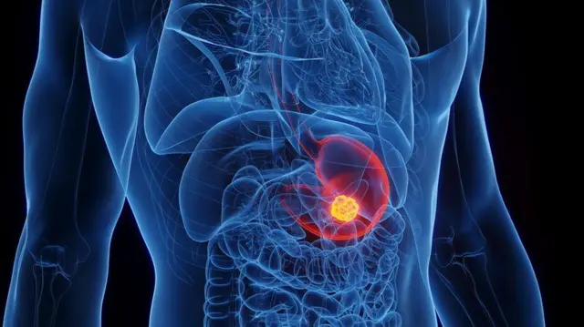 শরীরের ভেতরের অবস্থা বোঝার জন্য এন্ডোসকপি প্রয়োজন হয়