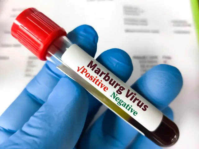 Ihe nlele ọbara maka nyocha ọrịa Marburg virus