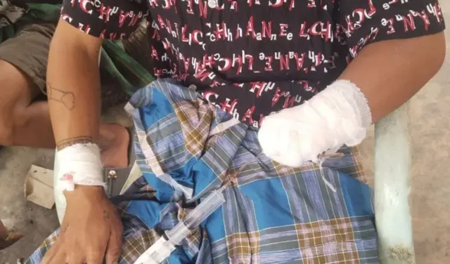 ပြီးခဲ့တဲ့မေလတုန်းက ရှမ်းမြောက်မှာ မြေမြှုပ်မိုင်းဒဏ် သင့်သူ တစ်ဦး