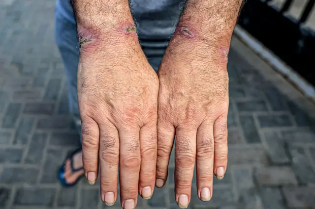 يدا رجل اعتقل من قبل الجيش الإسرائيلي في وقت سابق
