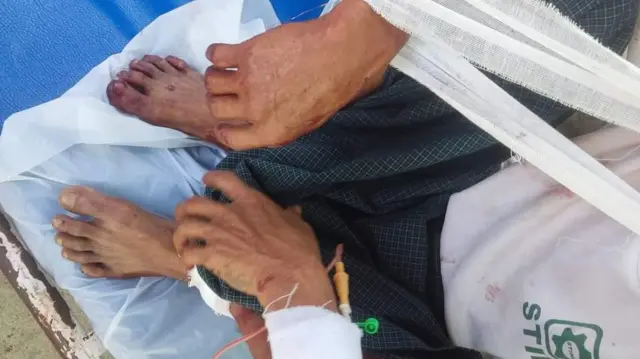 လေကြောင်းပစ်ခတ်မှုကြောင့် ထိခိုက်ဒဏ်ရာရသူတစ်ဦး