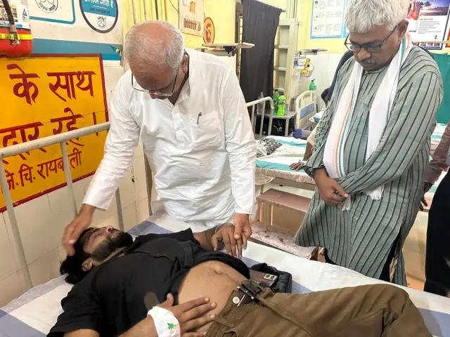 घायल पत्रकार से मिलने पहुंचे भूपेश बघेल