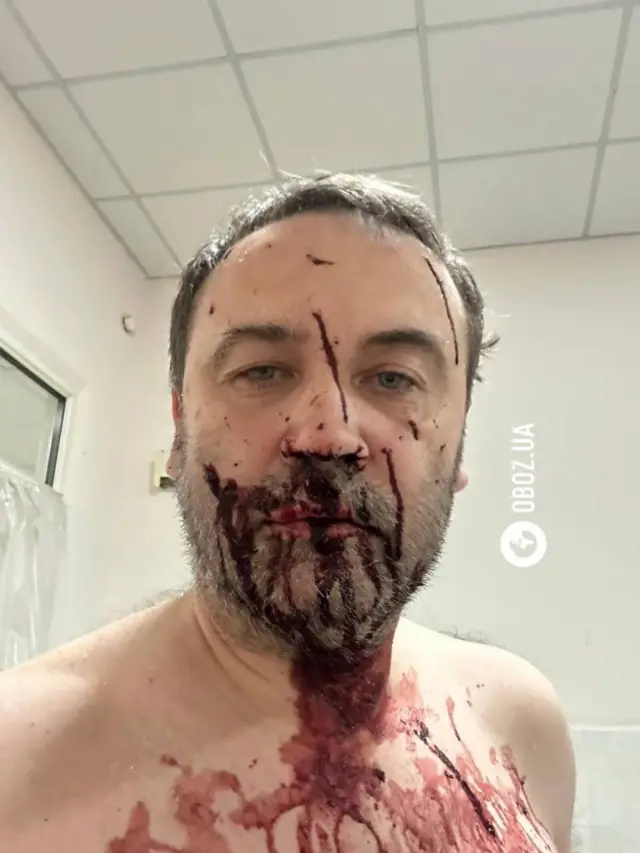 Пономарев со следами крови