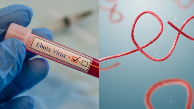 Ọrịa Ebola alaala na mba DR Kongo – Minista ahụike