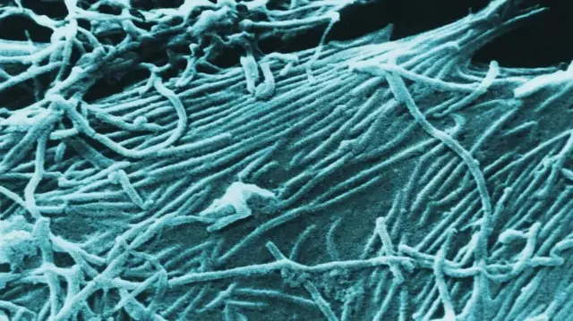Ihe ngosi ọrịa Ebola