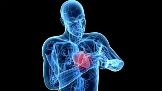 हार्ट अटैक