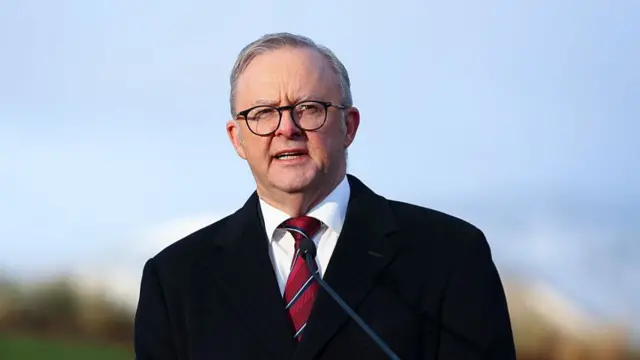 एंथनी अल्बनीज़