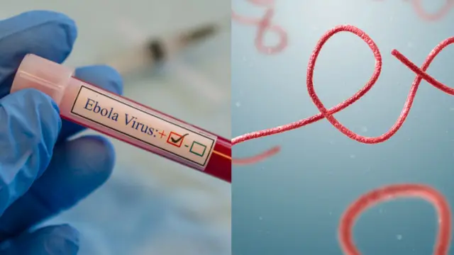 Ọrịa Ebola egbuola mmadụ 15 na DR Congo