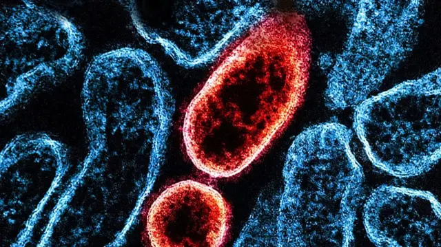 निपाह वायरस