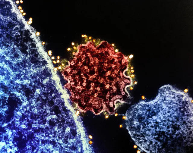 লাল অংশটি নিপাহ্ ভাইরাস