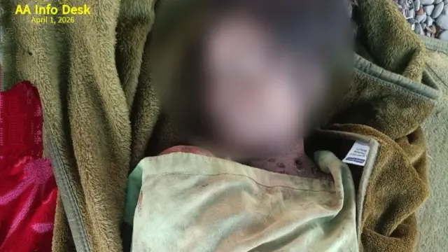 လေကြောင်းတိုက်ခိုက်မှုမှာ သေဆုံးခဲ့သူ ကလေးငယ်တစ်ဦးရဲ့ဓာတ်ပုံလို့ အေအေက ထုတ်ပြန်ပါတယ်