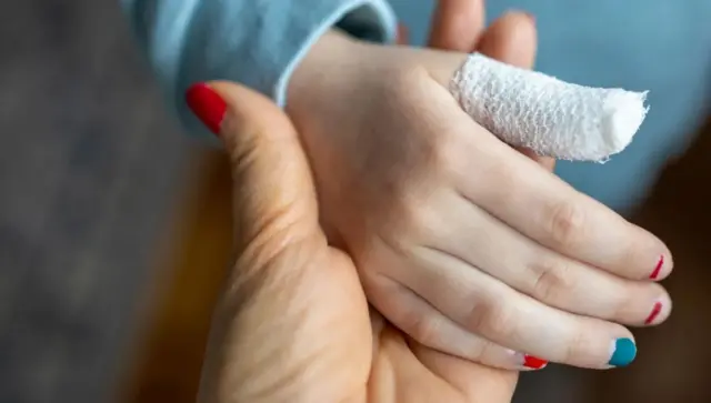 Ifoto y'ikiganza gifashe ikindi kiriho igipfuko n'inzara zisize ubururu n'umutuku.