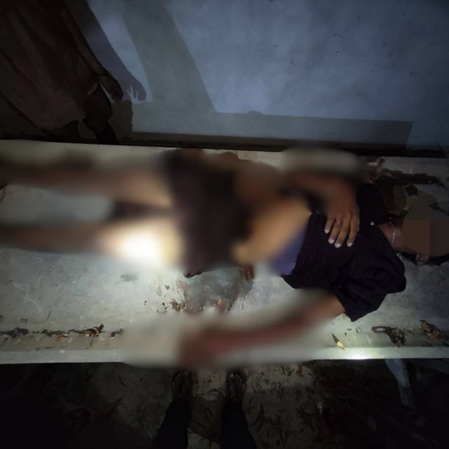 မိကျောင်းကိုက်ခံခဲ့ရတဲ့ အမျိုးသားတစ်ဦး