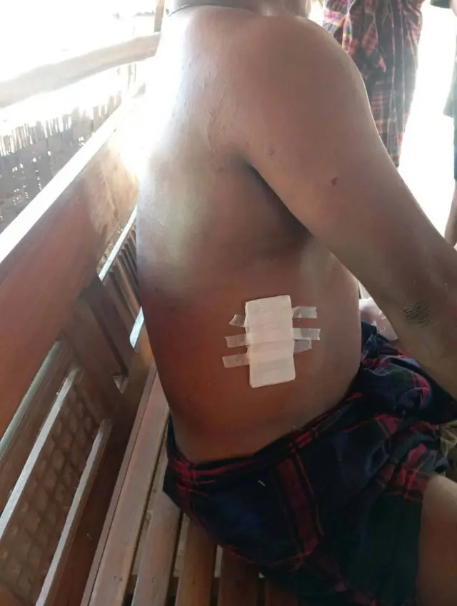 ဧပြီ ၂ ရက်က လေကြောင်းတိုက်ခိုက်မှုကြောင့် ထိခိုက်သွားတဲ့ အရပ်သားတစ်ဦး