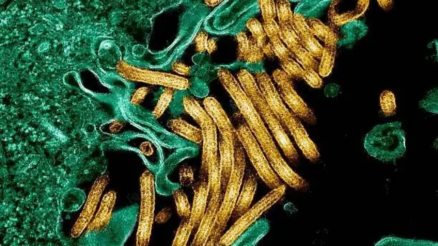 Ebola