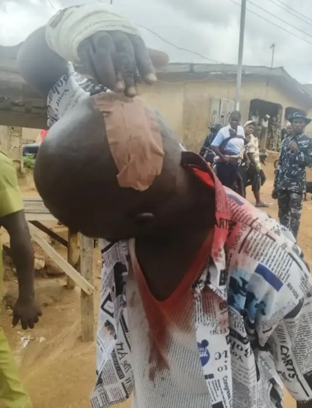 A man with a bandaged head.