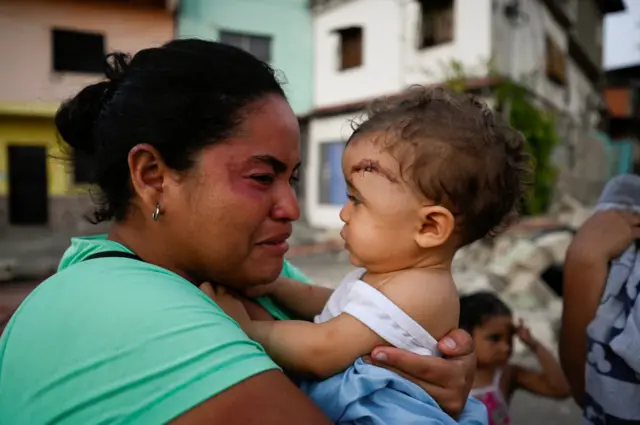 Una mujer sosteniendo una bebé en sus brazos en una zona afectada por los terremotos en Venezuela