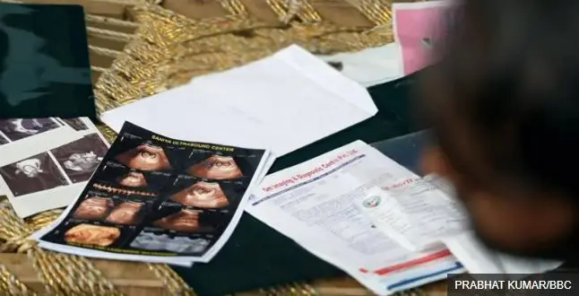 Ilmo ku samaysmay beerka hooyadii halkii u beermii lahaa ilmo galeenka dhacdo yaab leh Ilmo ku samaysmay beerka hooyadii halkii u beermii lahaa ilmo galeenka dhacdo yaab leh