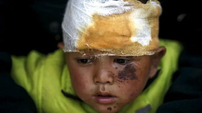 नेपाल का भूकंप पीड़ित बच्चा 