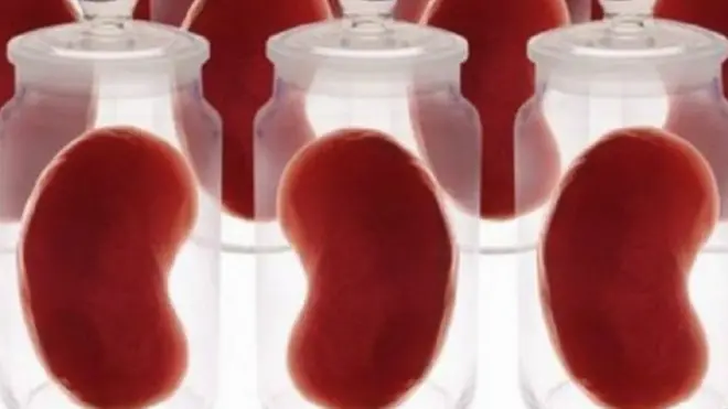 किडनी, अंगदान