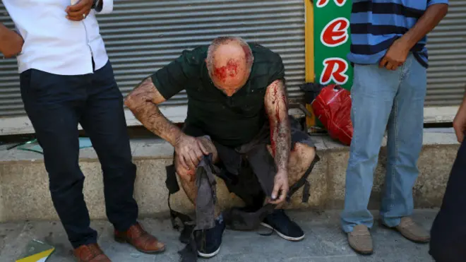 तुर्की में हुए धमाके में घायल हुआ एक आदमी