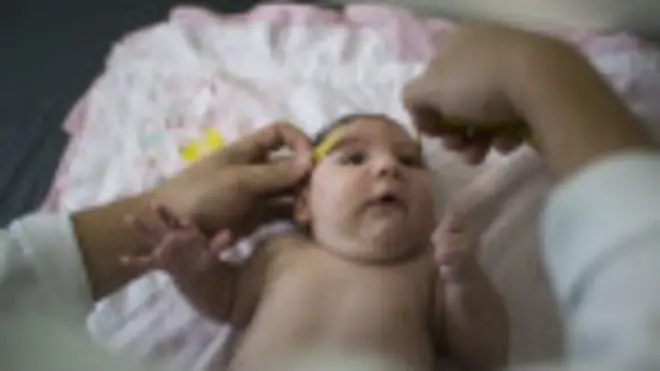 Bebê com microcefaliabetano bonus como funcionaCaruaru, Pernambuco | Foto: AP