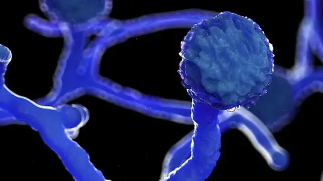 ब्लैक फंगस