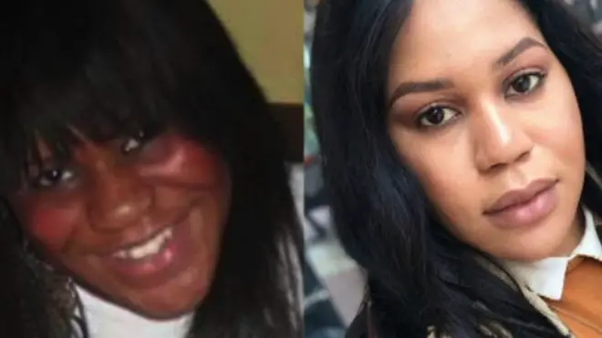 Grazia, kutoka Bradford, West Yorkshire, alikuwa na miaka 18 alipoanza kutumia krimu hizo