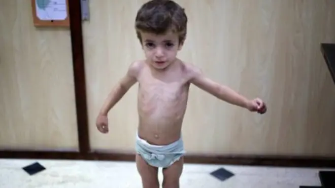 تعد الغوطة الشرقية واحدة من بين أربع مناطق يشملها اتفاق خفض التصعيد في سوريا الذي جرى التوصل إليه في محادثات أستانا.