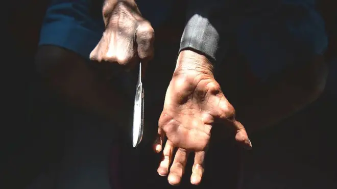 "ආපස්සට හැරවිය නොහැකි" සංකූලතා