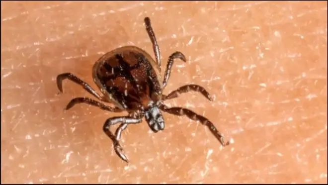 Shilinta nuugtaa dhiigga maqaarka dadka waxayna keentaa cudurka Lyme
