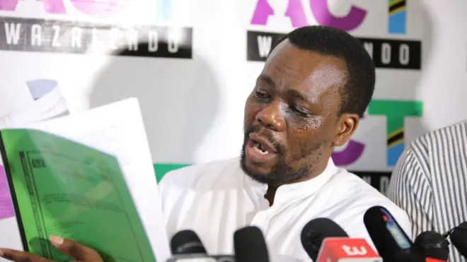 Kiongozi wa ACT -Wazalendo Zitto Kabwe