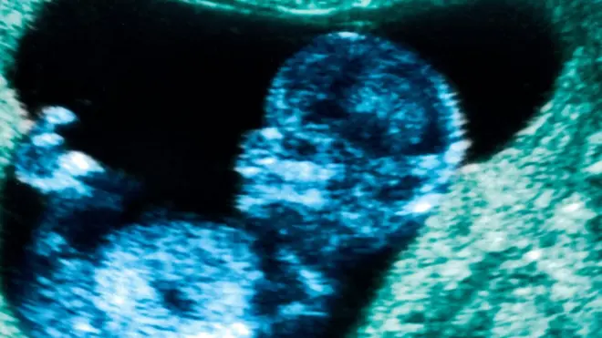 С какого момента вести отсчет жизни?