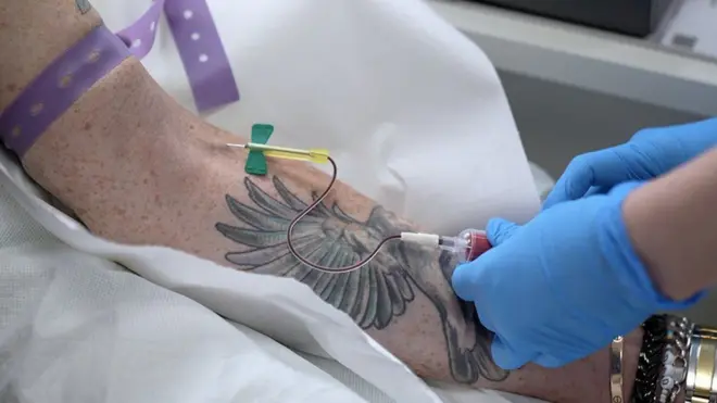 కీమోథెరపీ